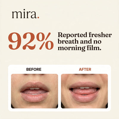 mira pod - The Aligner Reset