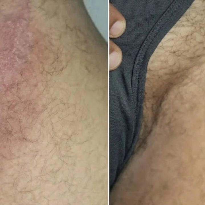 Review by “I can finally work out without itching!”